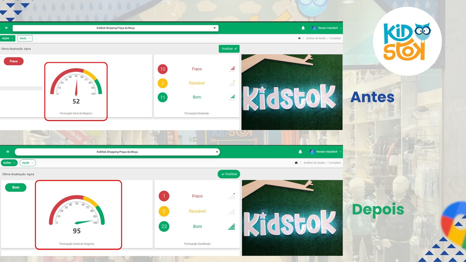 Antes e depois KidStok